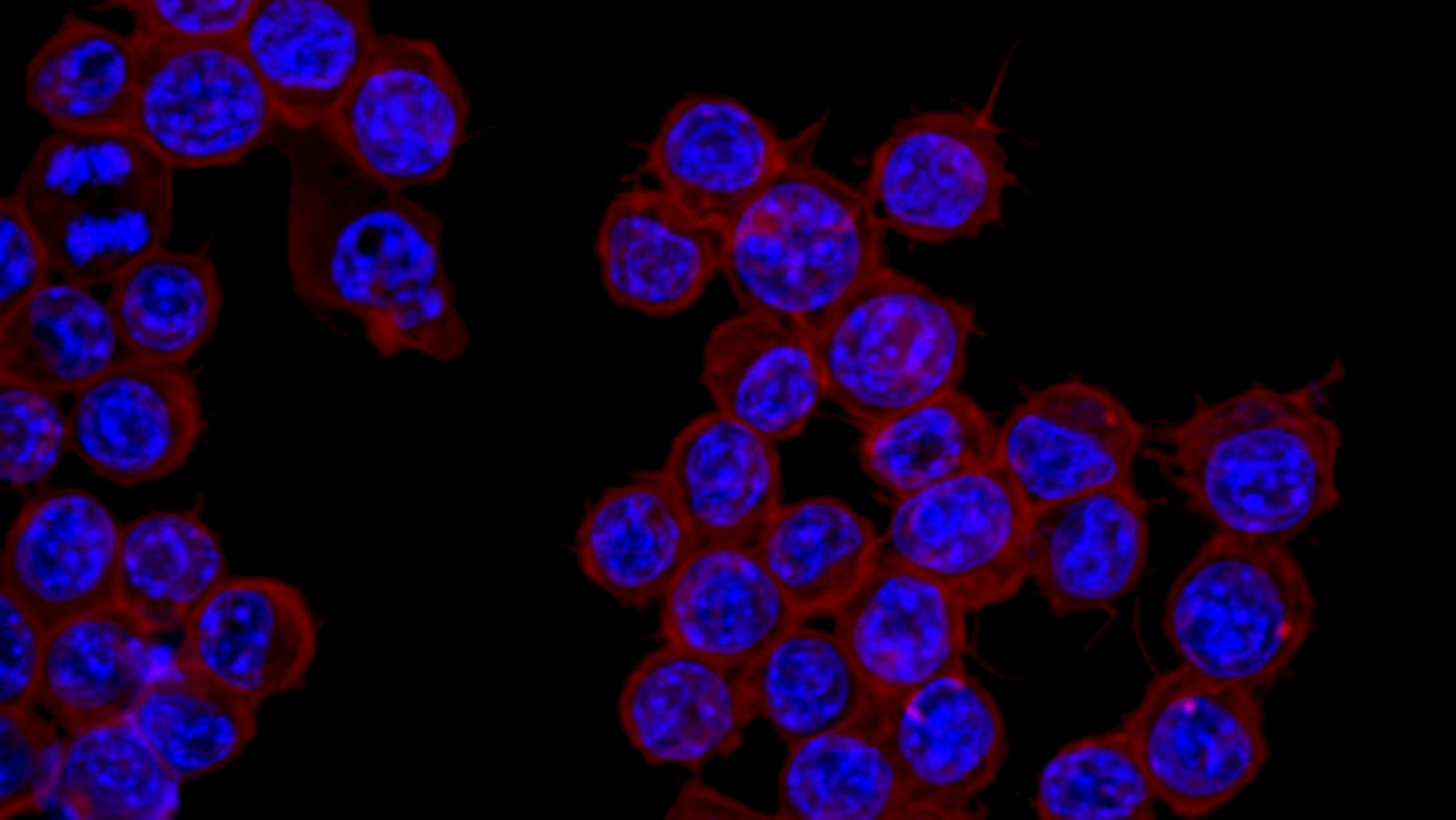Delivery of siRNA