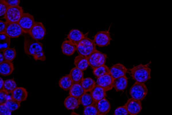 Delivery of siRNA