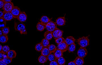 Delivery of siRNA